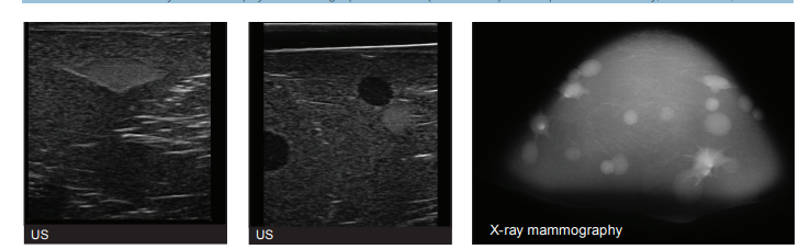 073多模態(tài)乳腺活檢和超聲訓(xùn)練器,SUN NUCLEAR073,073乳腺模體